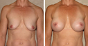 Before & After Photos